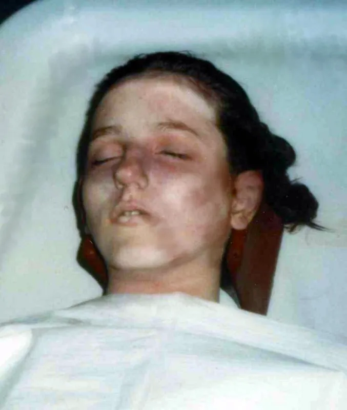 An unidentified woman located in California in 1979