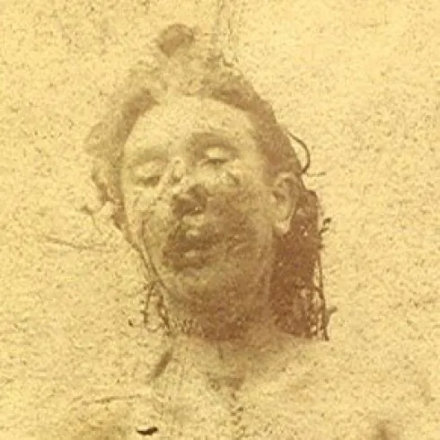 Victorian mortuary photograph of murder victim Catherine Eddowes